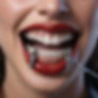 Vampire Fangs on Braces A close-up of braces adorned with vampire fangs.